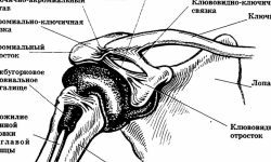 Артроз акромиально-ключичного сочленения