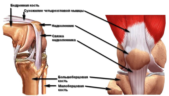 Вывих надколенника